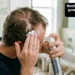 মিনোক্সিডিল ব্যবহার করে চুল পুনঃউৎপাদনের সম্ভাবনা ও ফলাফল প্রদর্শন করা হচ্ছে।